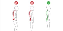 How Avoiding Back Pain Could Be As Basic As Muscle Memory