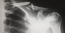 6 Ways To Prevent Injuries In The Workplace