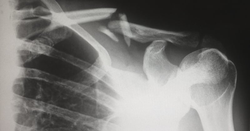 6 Ways To Prevent Injuries In The Workplace