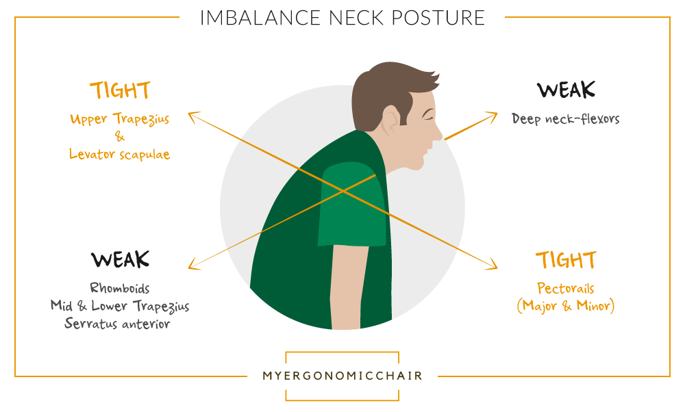 imbalance neck posture